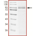 EGFR (T790M C797S L858R), Active